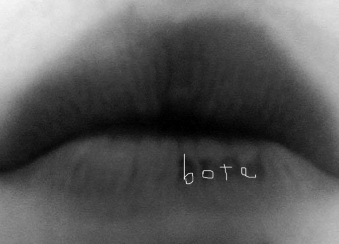 BOTE